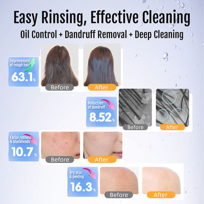 آلة سبا المهنية الميكرو نانوبوبل مولد نانو الفقاعات الهيدروجينية لتجديد البشرة والترطيب ومعالجات الجمال المضادة للشيخوخة